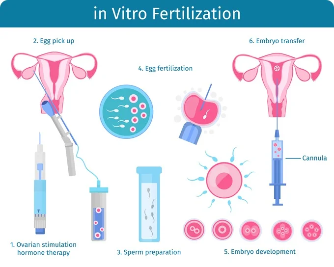 IVF research: What are the latest advances, and what obstacles stand in the way?